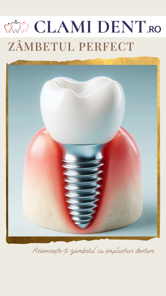 Implanturi Dentare Cum Să Îți Recapeți Încrederea în Tine