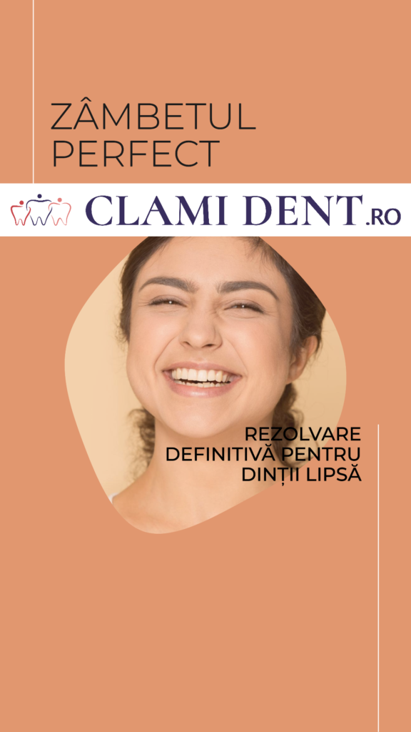 Implanturi Dentare Soluția Permanentă pentru Dinții Lipsă