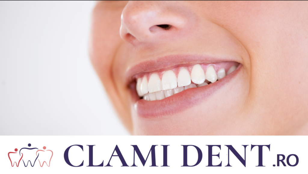 Cât Costă un Implant Dentar în 2024 Alba Iulia Clinica Stomatologica ClamiDent