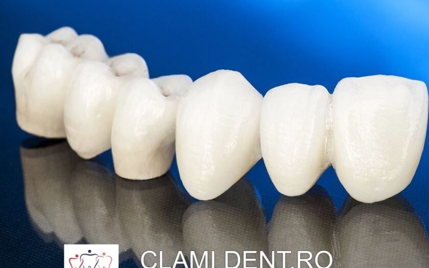 Conturarea și Remodelarea Dinților