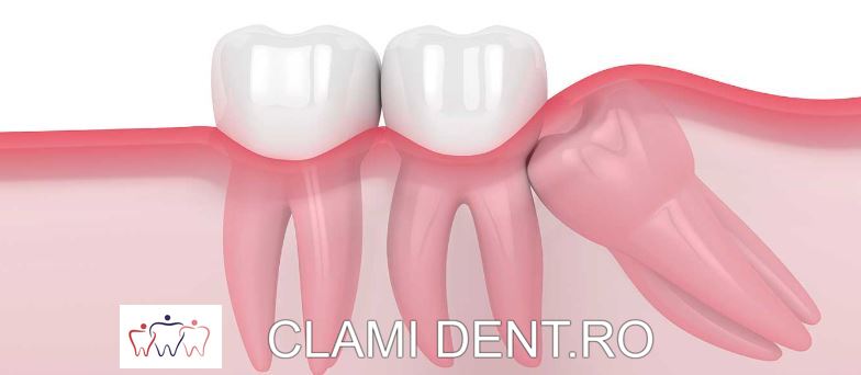 Diagnosticarea Afecțiunilor Dentare Complexe