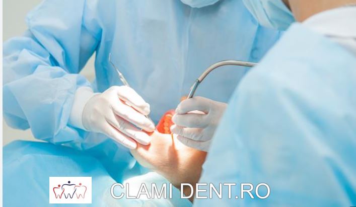 Intervențiile Chirurgicale Endodontice