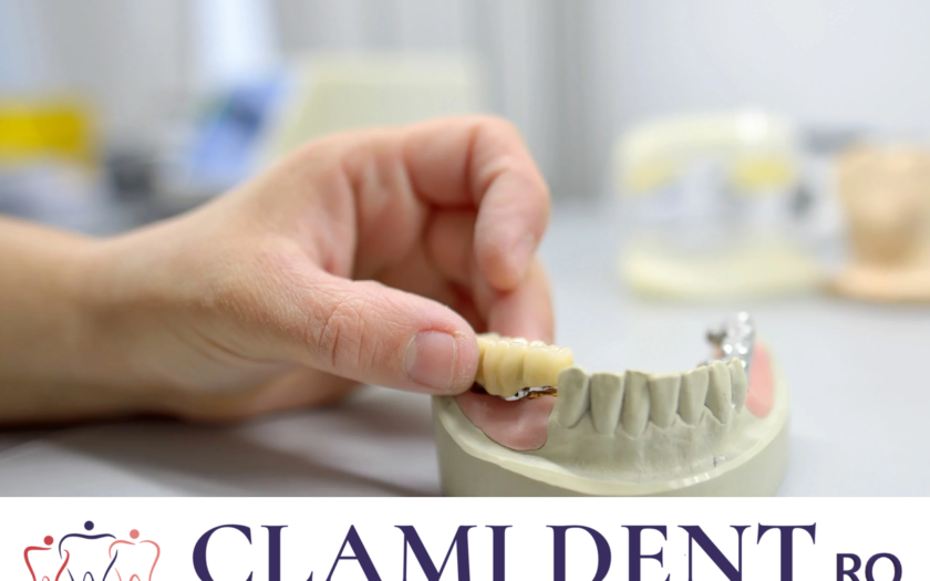 Întrebări Frecvente implanturilor dentare Alba Iulia Clinica Stomatologica ClamiDent