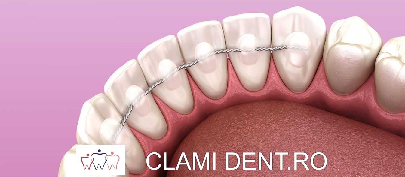 stabilizare dinți mobili Alba Iulia