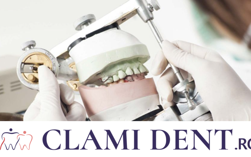 5 Motive Pentru a Investi în Implanturi Dentare la Clinica Stomatologică Clami Dent din Alba Iulia