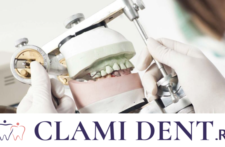 5 Motive Pentru a Investi în Implanturi Dentare Alba Iulia Clinica Stomatologica ClamiDent