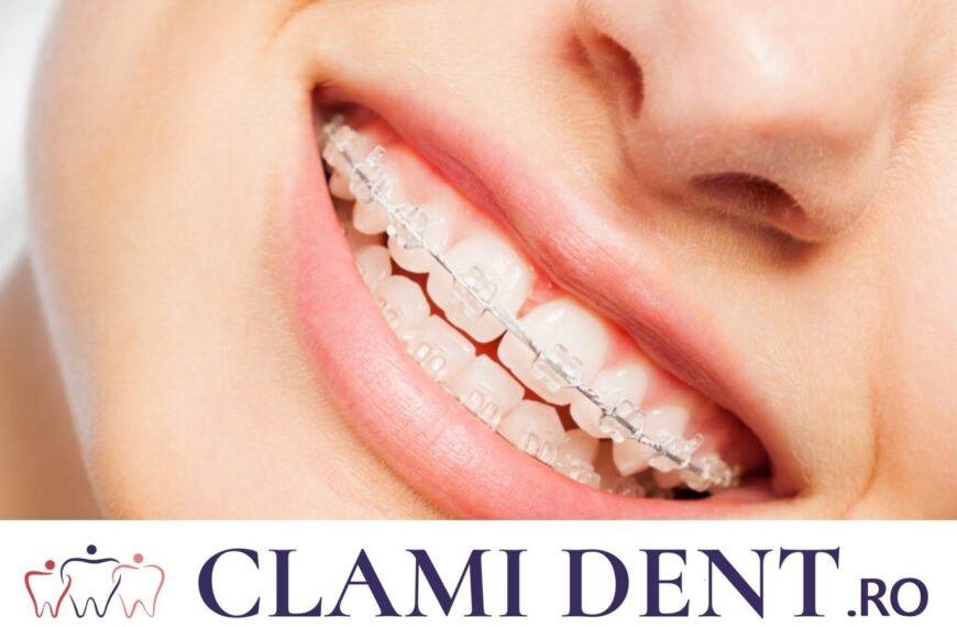 Aparat Dentar Alba Iulia clinica stomatologica
