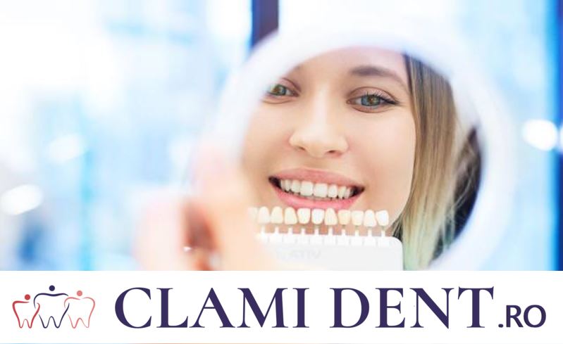 Bleaching Dentar Alba Iulia Clami Dent Clinca Stomatologica