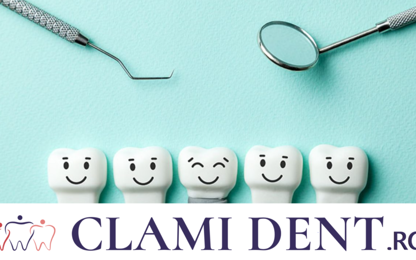 Ce Probleme pot aparea la Implanturile Dentare și Cum Să le Eviti Alba Iulia Clinica Stomatologica ClamiDent