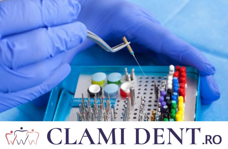 Chistul Dentar Alba Iulia Clami Dent
