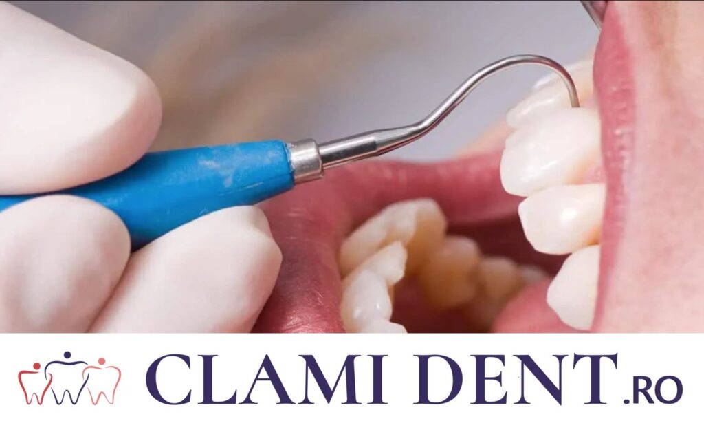 Dentist Alba Iulia clinica stomatologica clamident