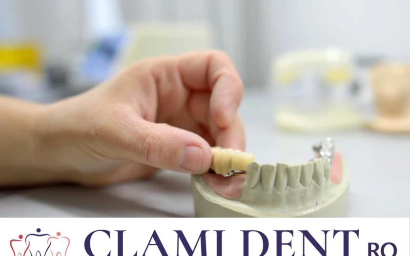 Recuperarea După Implant Dentar: Sfaturi și Trucuri Alba Iulia Clinica Stomatologica ClamiDent