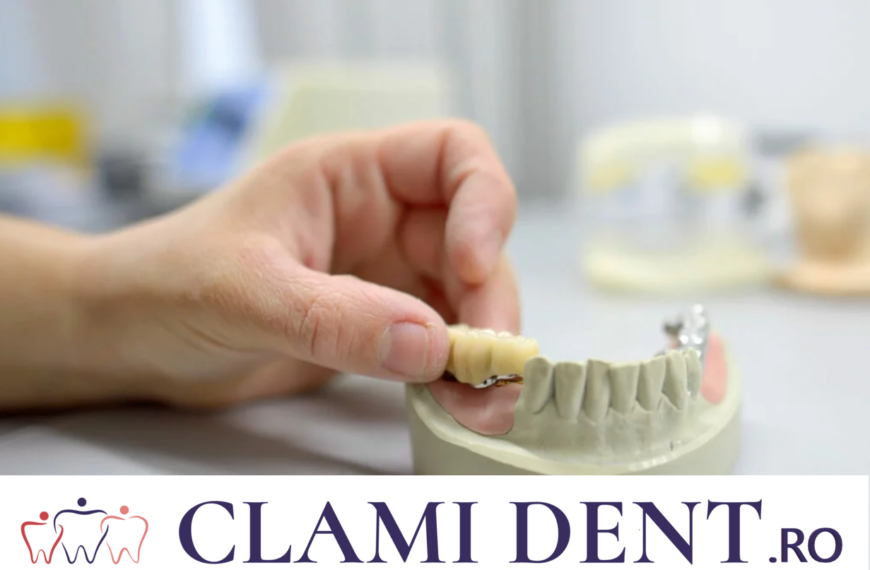 Recuperarea După Implant Dentar: Sfaturi și Trucuri Alba Iulia Clinica Stomatologica ClamiDent