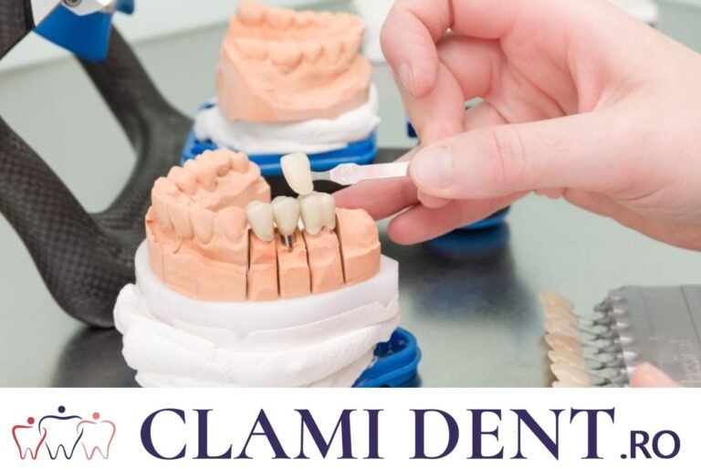 Model dentar folosit pentru explicarea restaurărilor pe implanturi
