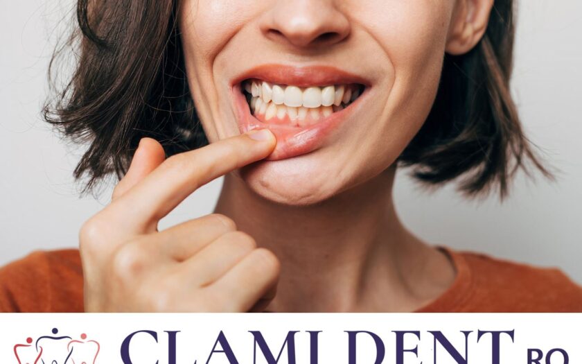 Este Dureros un Tratament de Canal? alba iulia