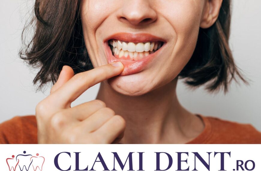 Este Dureros un Tratament de Canal? alba iulia