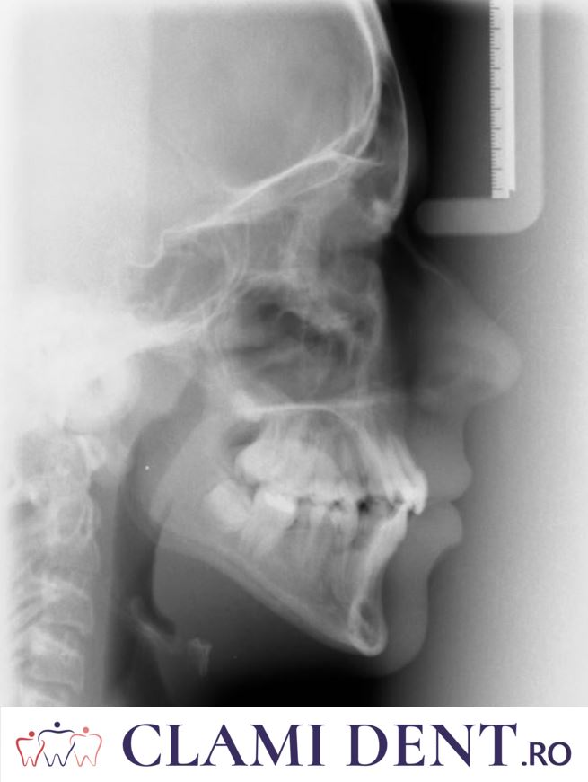 Radiografia Dentară Alba Iulia