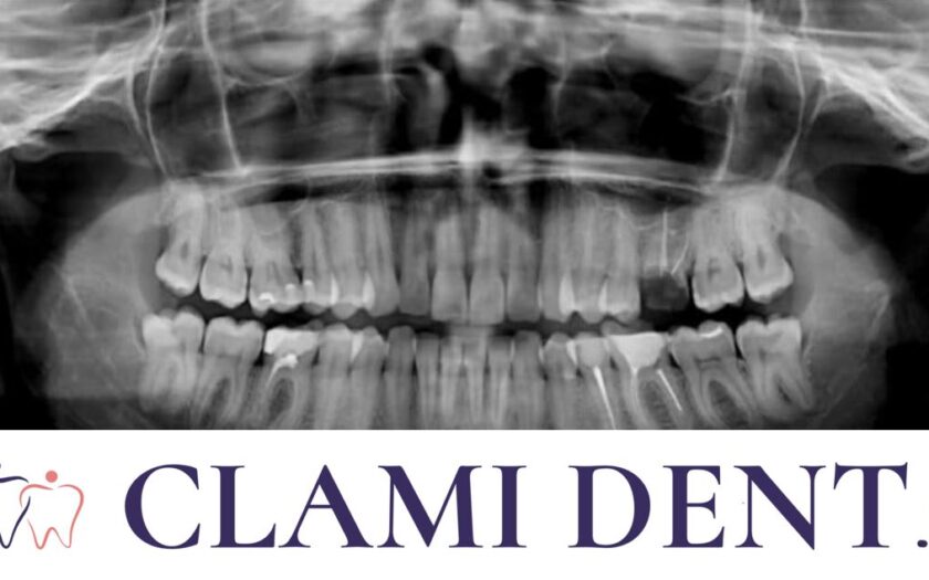 Radiografia Dentară Alba Iulia