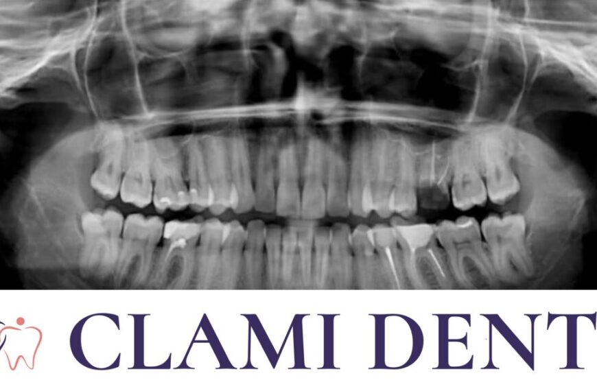 Radiografia Dentară Alba Iulia