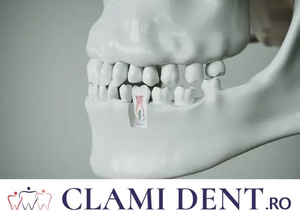 osul alveolar clinica stomatologica alba iulia clami dent