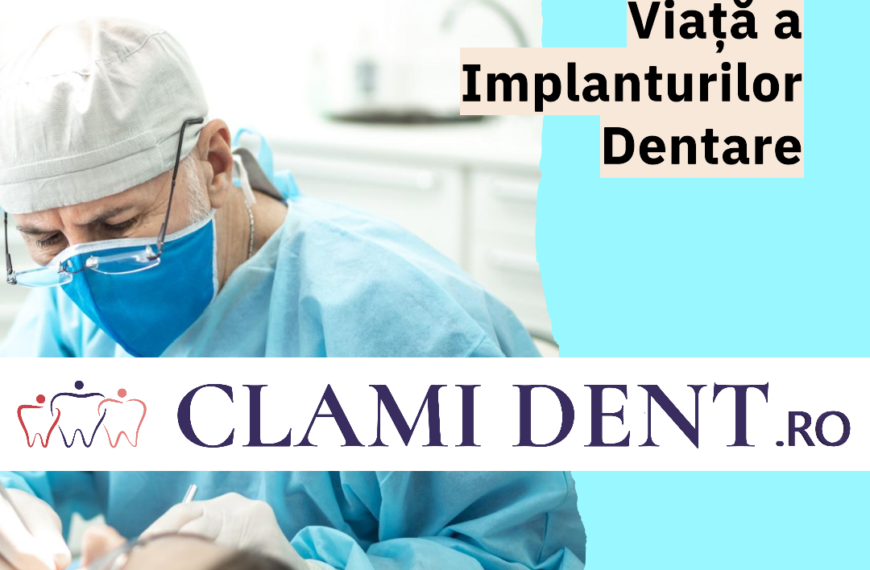 Care este durata de viață a implanturilor dentare? Ghid complet de la Clami Dent, Alba Iulia