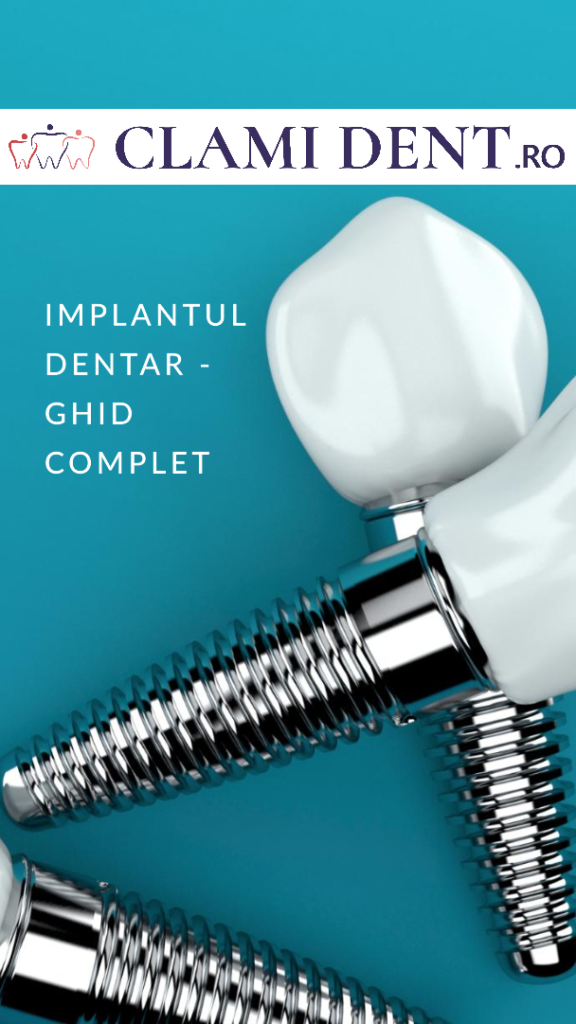 Este dureroasă procedura de implant dentar? Ghid complet de la Clami Dent, Alba Iulia