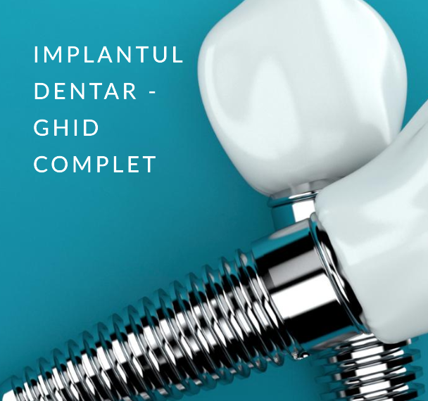 Este dureroasă procedura de implant dentar? Ghid complet de la Clami Dent, Alba Iulia