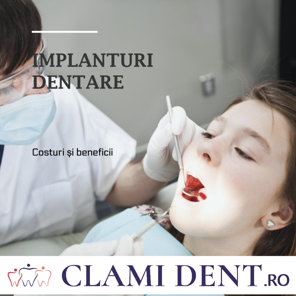 Care sunt costurile asociate cu implanturile dentare?