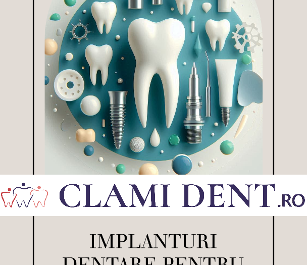 Pot beneficia de implanturi dentare dacă sufăr de boală parodontală? Ghid complet de la Clami Dent, Alba Iulia