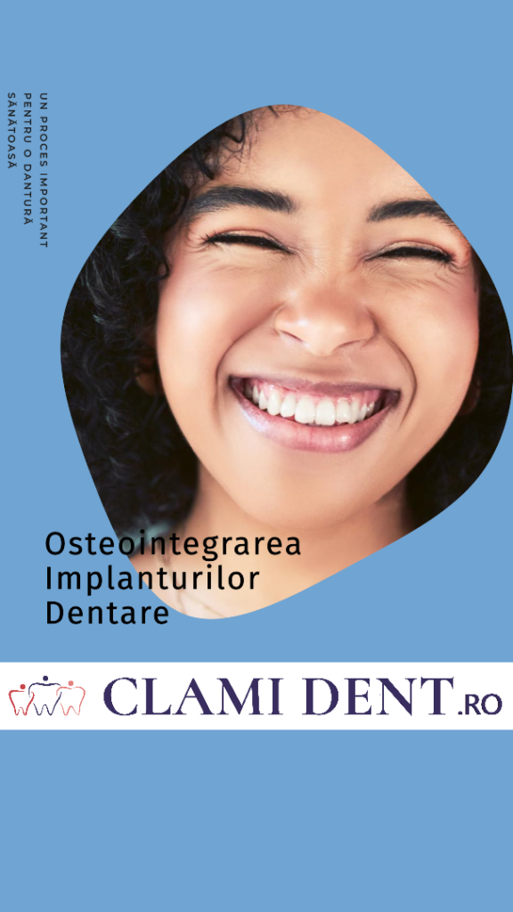 Cum se realizează osteointegrarea implanturilor dentare?