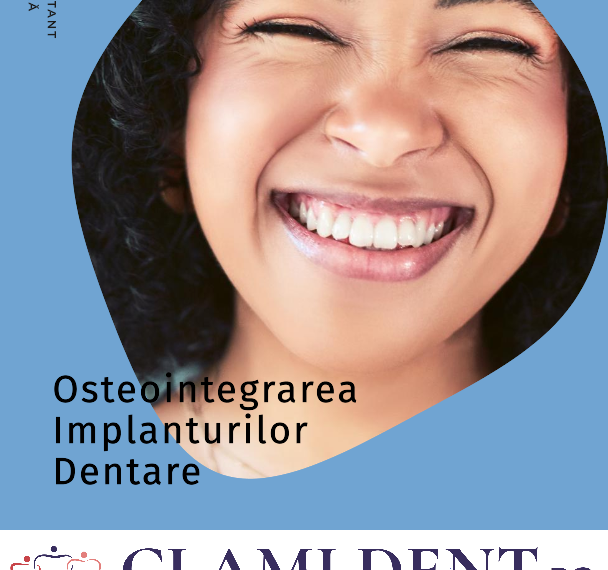 Cum se realizează osteointegrarea implanturilor dentare?