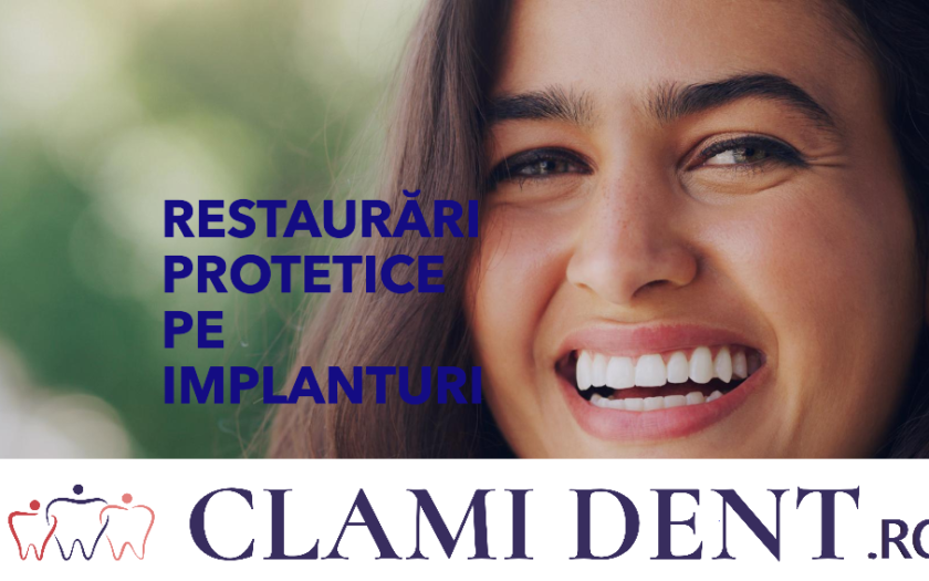 Restaurări protetice pe implanturi la Clami Dent din Alba Iulia: Cazuri de succes