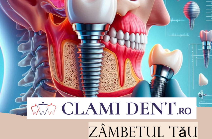 Pot beneficia de implanturi dentare dacă nu am os suficient? Ghid complet de la Clami Dent, Alba Iulia