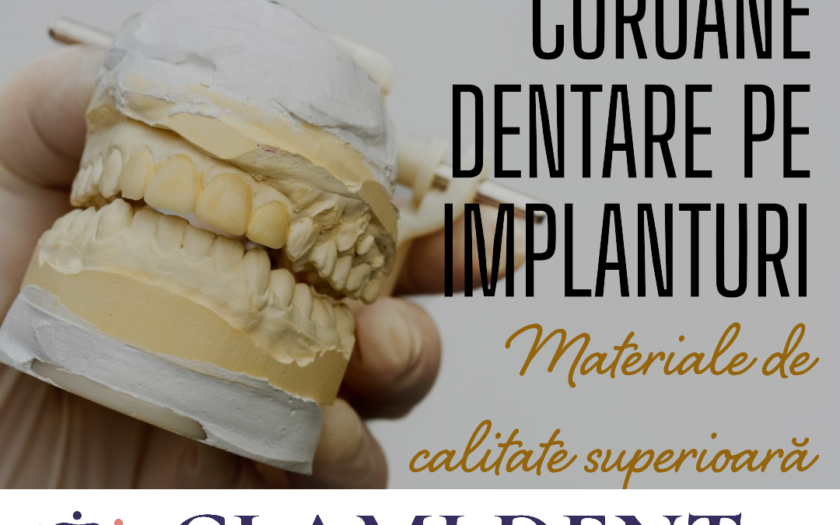 Cum pot să aleg materialul potrivit pentru coroanele dentare pe implanturi?