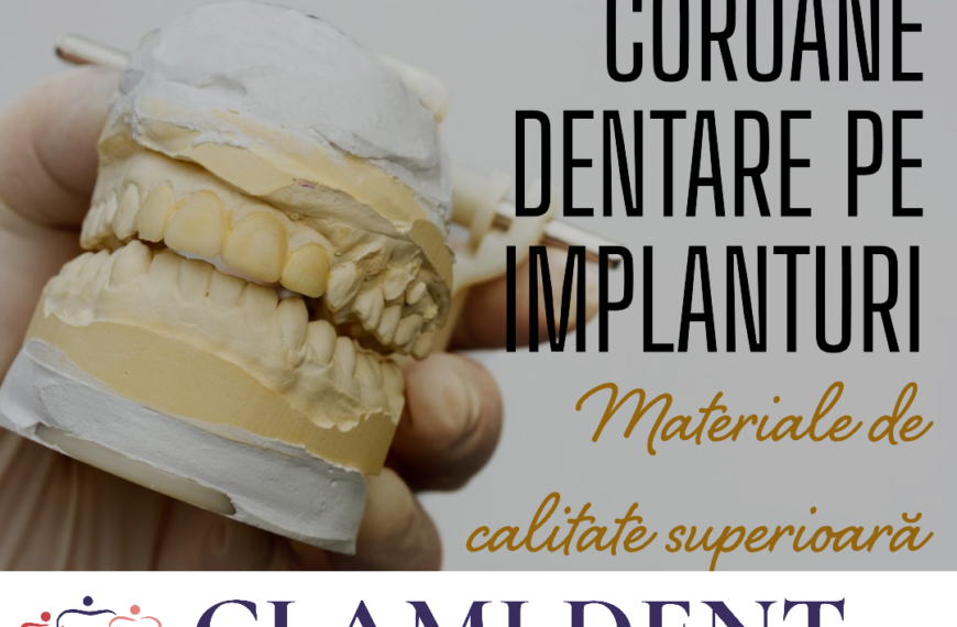 Cum pot să aleg materialul potrivit pentru coroanele dentare pe implanturi?