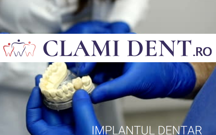 Ce implicații are o extracție dentară asupra procesului de implantare?