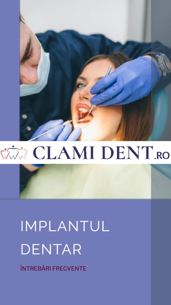 Cât durează procedura de implant dentar?