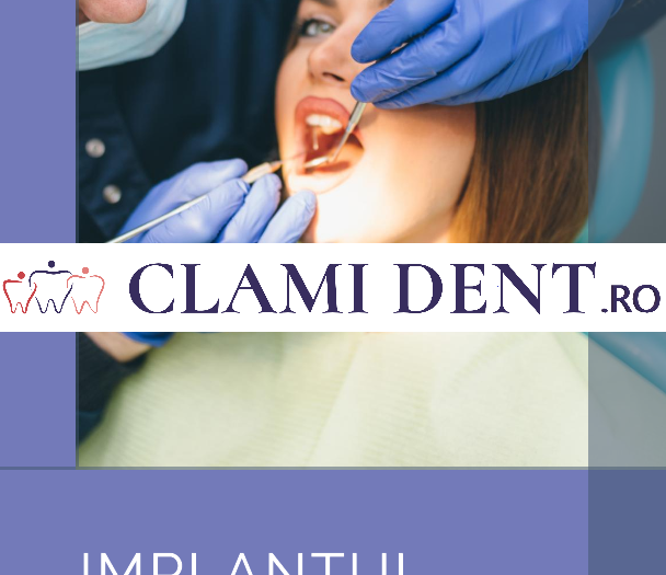 Cât durează procedura de implant dentar?