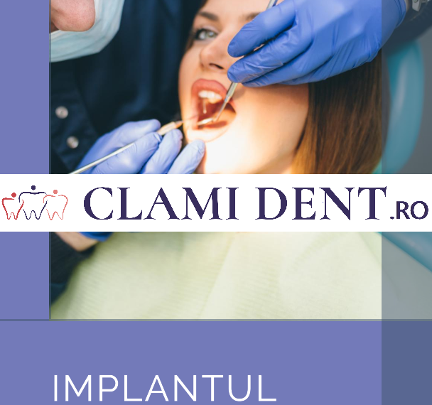 Cât durează procedura de implant dentar?