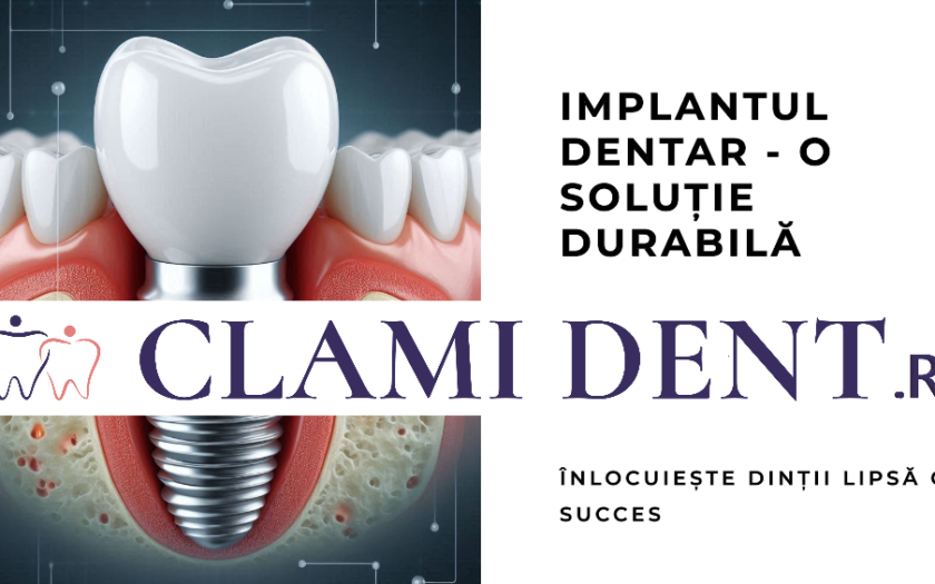 Cât de durabil este un implant dentar?