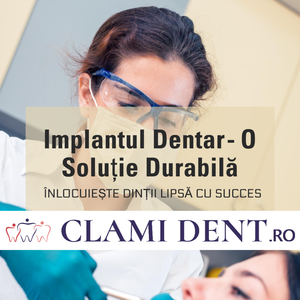 Cum funcționează un implant dentar?