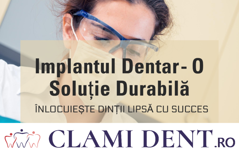 Cum funcționează un implant dentar?