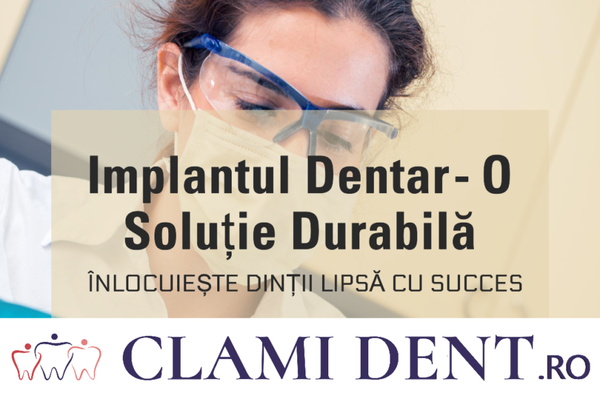 Cum funcționează un implant dentar?