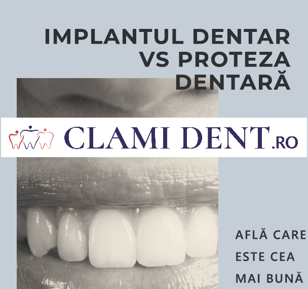 Care este diferența între un implant dentar și o proteză dentară?