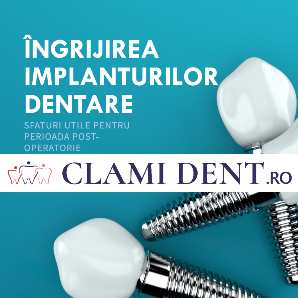 Cum pot să am grijă de implanturile dentare după procedură