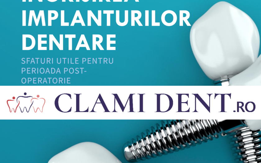 Cum pot să am grijă de implanturile dentare după procedură