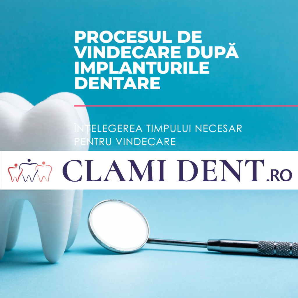 Cât timp durează procesul de vindecare după implanturile dentare?