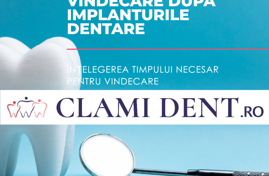 Cât timp durează procesul de vindecare după implanturile dentare?