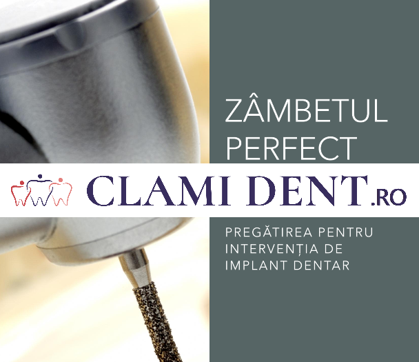 Cum trebuie să mă pregătesc pentru o intervenție de implant dentar?