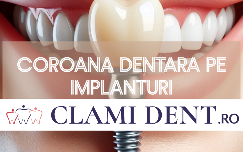 coroană dentară în protetica dentară pe implanturi?